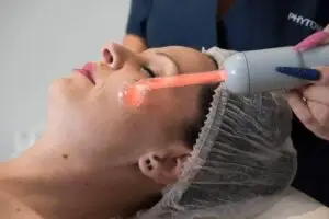 Anti-acne facial treatment